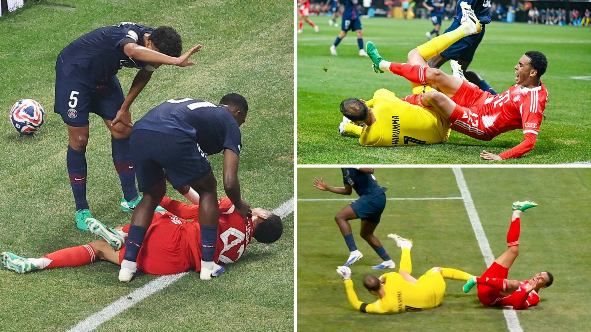 瓦伦西亚传奇：球星大腿受伤的简单介绍